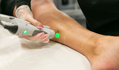 Process Of Laser Hair Removal For Legs By Simplicity Laser
