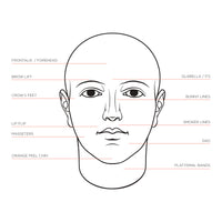 60 Units Botox! - Introductory Offer - Only $399!