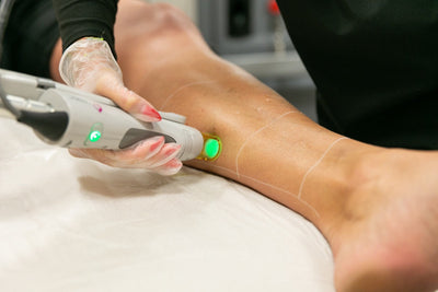 Does Laser Hair Removal Affect Tattoos? What You Need to Know