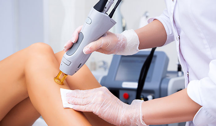 Preparing Your Skin for Laser Hair Removal