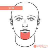 Chin & Lip Women's 16-Treatment Monthly Program - $39/Month