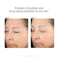 PCA Skin Hyaluronic Acid Boosting Serum