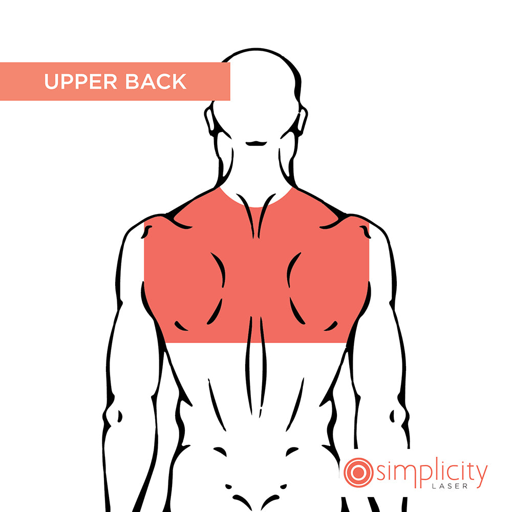 Upper Back Men's 4-Treatment Starter Package